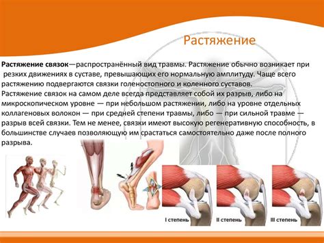 Причины и симптомы разрыва связок