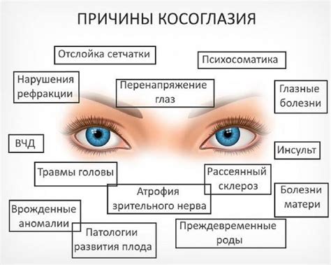 Причины косоглазия у детей