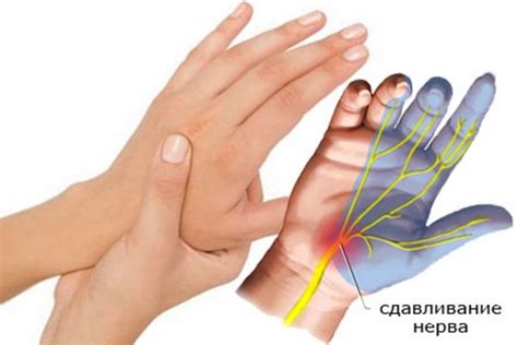Причины немощи левой руки из-за нервных переживаний