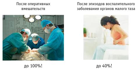 Причины повышения температуры при спайках яичников