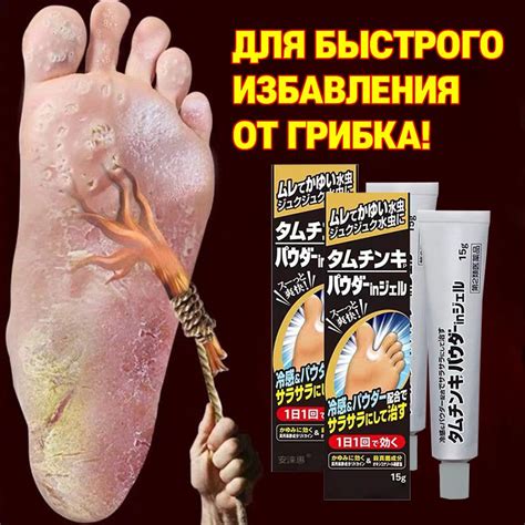 Процедуры для лечения грибка стопы