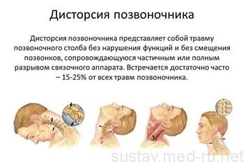 Растяжение шеи