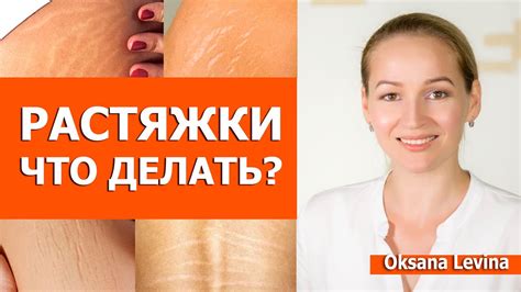 Растяжки: что это и почему они возникают