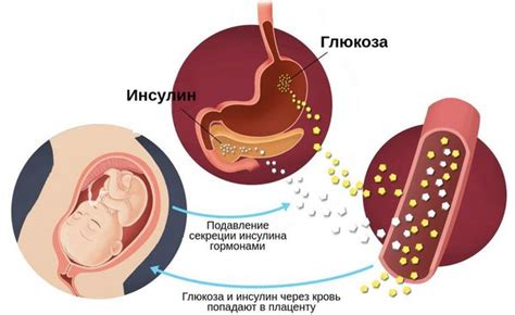 Рис и гестационный диабет: