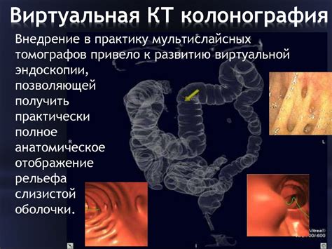 Свекла при эрозии желудочно-кишечного тракта