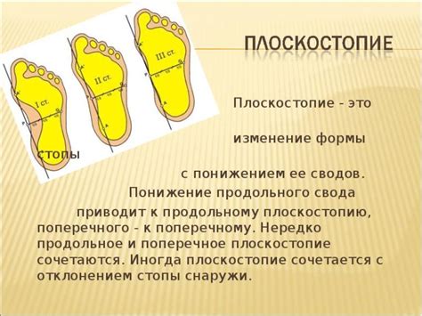 Связь между плоскостопием и отеками