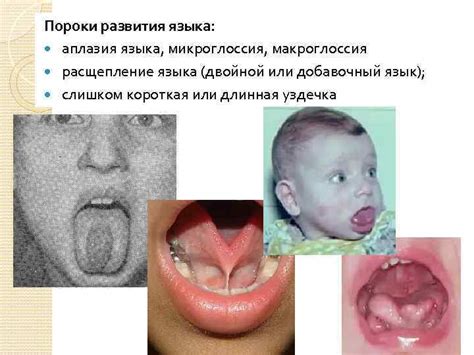 Симптомы прокола языка