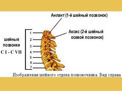 Симптомы шейного хондроза: