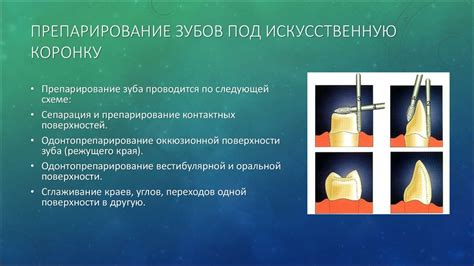 Стачивание коронки: риски и цели