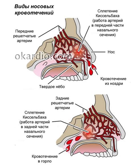 Стресс и перепады температуры как причины крови из носа