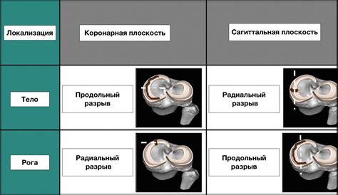 Тип повреждения