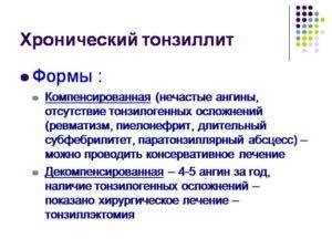 Тонзиллит и его влияние на суставы: понимание проблемы