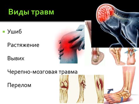 Травмы и профилактика