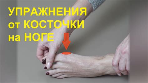 Тренировки с гигромой на ноге: эффективные варианты