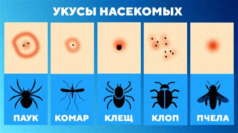 Укусы стрекоз: причины и последствия