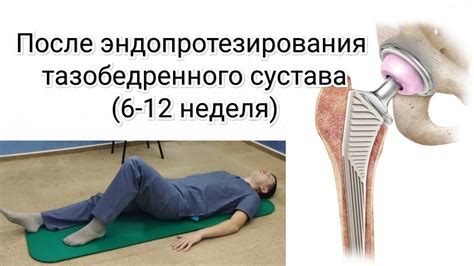 Уход после сводки