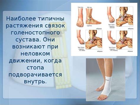 Физиотерапия при разрыве связок