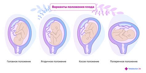 Шевеления плода и его положение