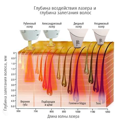  Безопасность и возможные осложнения при комбинировании филлеров и лазерной эпиляции